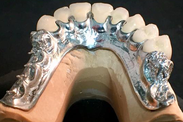 Prótesis removible. FJ Laboratorio dental