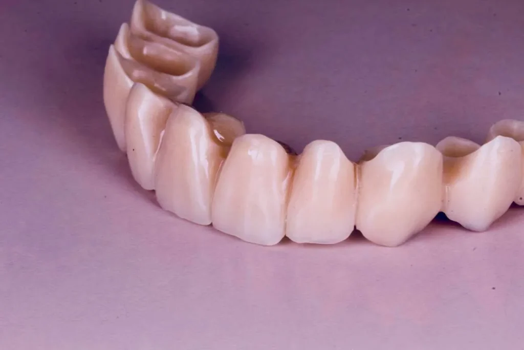 Provisionales pmma multilayer