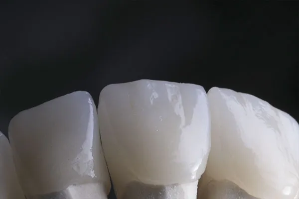 Trabajos FJ Laboratorio dental