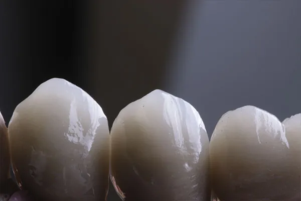 Trabajos FJ Laboratorio dental