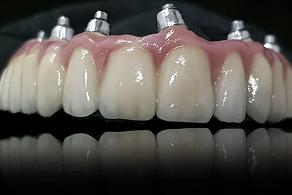 Trabajos FJ Laboratorio dental
