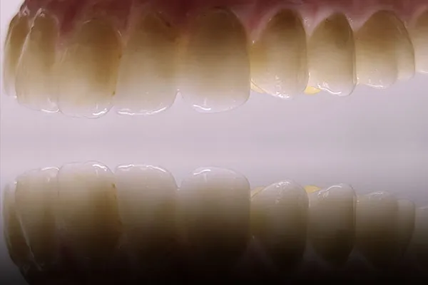 Trabajos FJ Laboratorio dental
